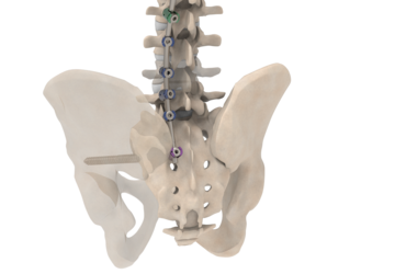 © 2025 ulrich medical. Alle Rechte vorbehalten. Die Verwendung, Vervielfältigung oder Weitergabe ohne ausdrückliche Genehmigung ist nicht gestattet.