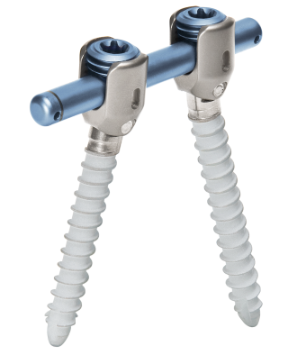 Imagen general del sistema de varilla-tornillo para la estabilización dinámica de la columna vertebral cosmicMIA de ulrich medical 