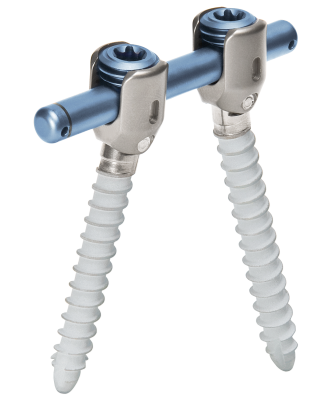 Overview image of the screw-rod system for dynamic stabilization of the spine cosmicMIA from ulrich medical 