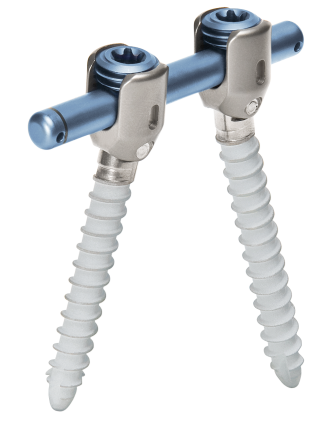 Overview image of the screw-rod system for dynamic stabilization of the spine cosmicMIA from ulrich medical 