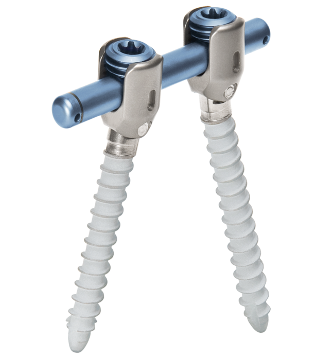 Imagen general del sistema de varilla-tornillo para la estabilización dinámica de la columna vertebral cosmicMIA de ulrich medical  | © Ulrich Medical. Todos los derechos reservados. Queda prohibido el uso, la reproducción o la distribución sin autorización expresa.