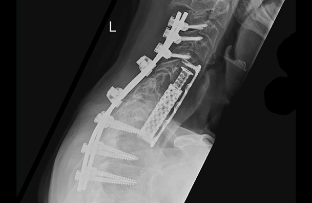 © Ulrich Medical. Todos los derechos reservados. Queda prohibido el uso, la reproducción o la distribución sin autorización expresa. © Ulrich Medical. Todos los derechos reservados. Queda prohibido el uso, la reproducción o la distribución sin autorización expresa.