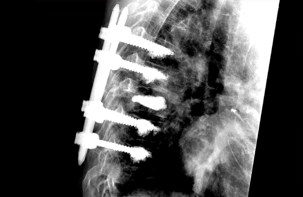 © ulrich medical. All rights reserved. Use, reproduction or transfer without express authorization is not permitted.
