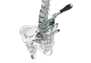 © ulrich medical. All rights reserved. Use, reproduction or transfer without express authorization is not permitted.