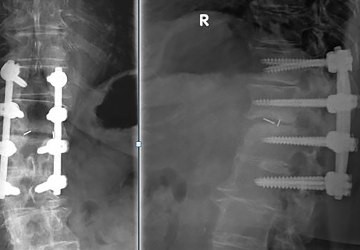 © ulrich medical. All rights reserved. Use, reproduction or transfer without express authorization is not permitted.
