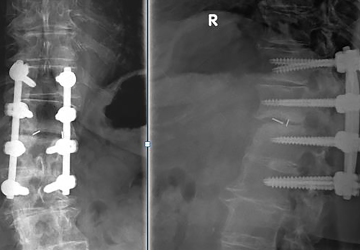 © ulrich medical. Tous droits réservés. L'utilisation, la reproduction ou la transmission sans autorisation expresse est interdite.
