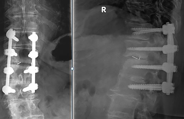 © ulrich medical. All rights reserved. Use, reproduction or transfer without express authorization is not permitted.