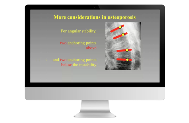 © 2025 ulrich medical. Alle Rechte vorbehalten. Die Verwendung, Vervielfältigung oder Weitergabe ohne ausdrückliche Genehmigung ist nicht gestattet.