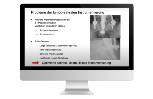 © 2025 ulrich medical. Alle Rechte vorbehalten. Die Verwendung, Vervielfältigung oder Weitergabe ohne ausdrückliche Genehmigung ist nicht gestattet.