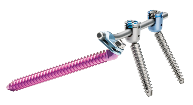 © ulrich medical. Tous droits réservés. L'utilisation, la reproduction ou la transmission sans autorisation expresse est interdite.
