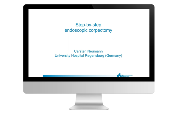 © 2025 ulrich medical. Alle Rechte vorbehalten. Die Verwendung, Vervielfältigung oder Weitergabe ohne ausdrückliche Genehmigung ist nicht gestattet.