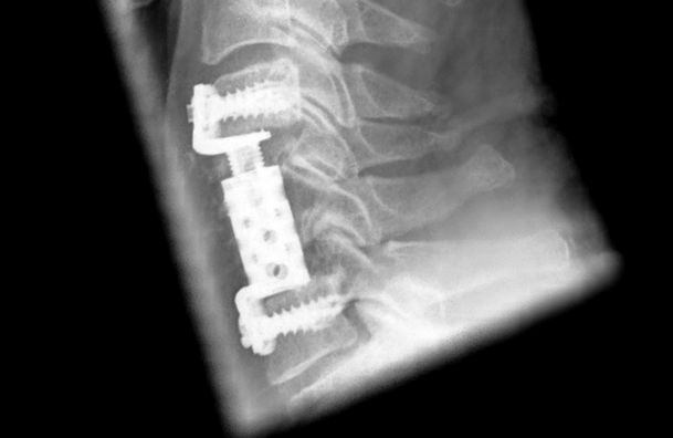 © ulrich medical. All rights reserved. Use, reproduction or transfer without express authorization is not permitted.