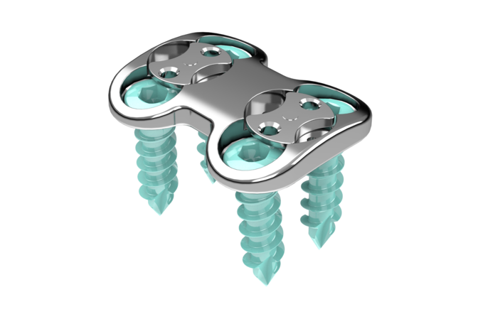 © Ulrich Medical. Todos los derechos reservados. Queda prohibido el uso, la reproducción o la distribución sin autorización expresa.