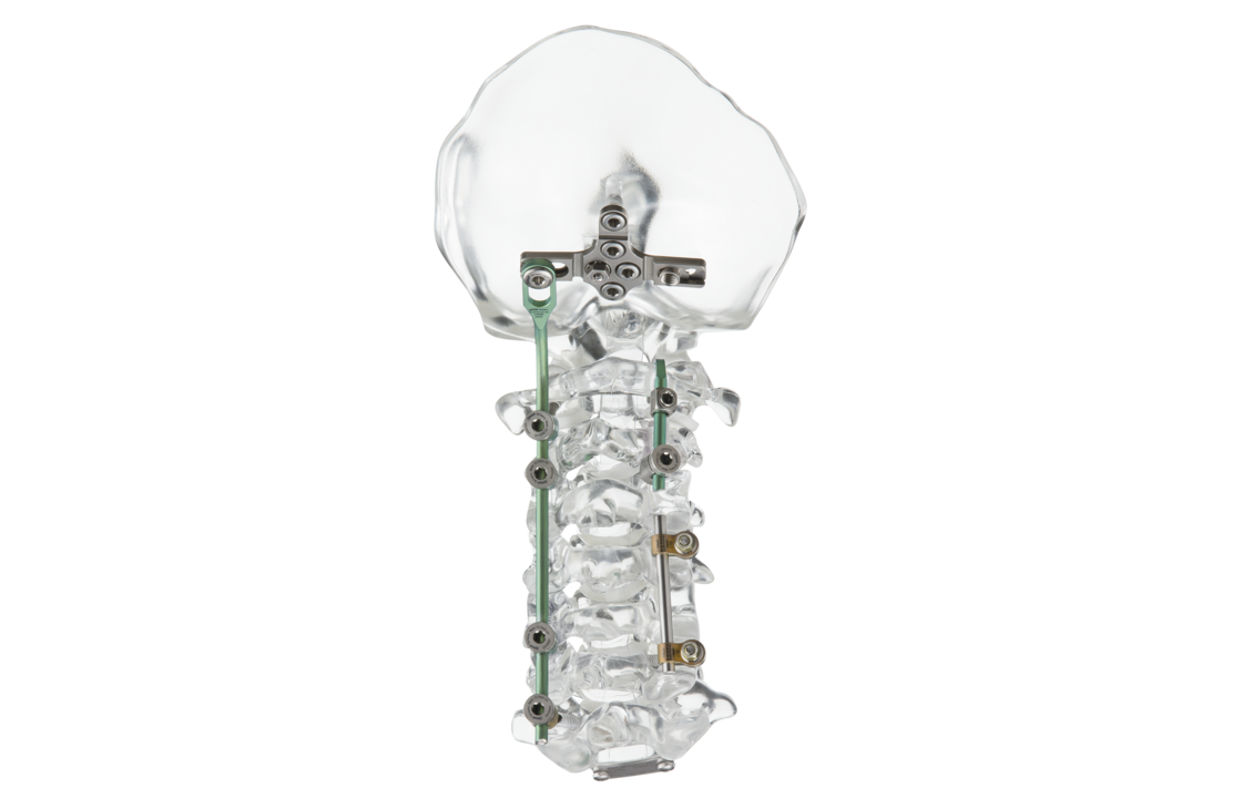 © ulrich medical. All rights reserved. Use, reproduction or transfer without express authorization is not permitted.