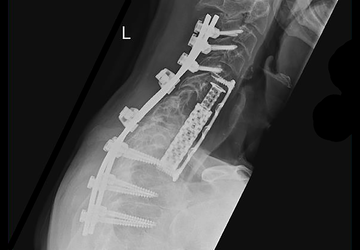 © ulrich medical. All rights reserved. Use, reproduction or transfer without express authorization is not permitted.