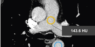 © 2025 ulrich medical. Alle Rechte vorbehalten. Die Verwendung, Vervielfältigung oder Weitergabe ohne ausdrückliche Genehmigung ist nicht gestattet.