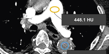 © 2025 ulrich medical. Alle Rechte vorbehalten. Die Verwendung, Vervielfältigung oder Weitergabe ohne ausdrückliche Genehmigung ist nicht gestattet.