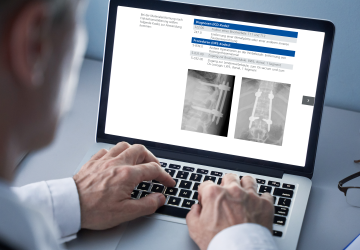 © 2025 ulrich medical. Alle Rechte vorbehalten. Die Verwendung, Vervielfältigung oder Weitergabe ohne ausdrückliche Genehmigung ist nicht gestattet.