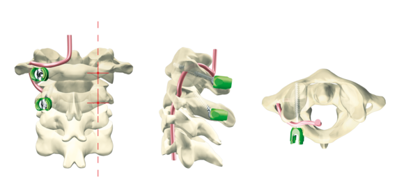 © ulrich medical. All rights reserved. Use, reproduction or transfer without express authorization is not permitted.
