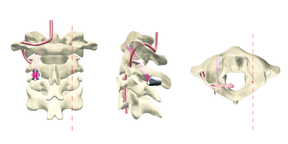 © ulrich medical. All rights reserved. Use, reproduction or transfer without express authorization is not permitted.