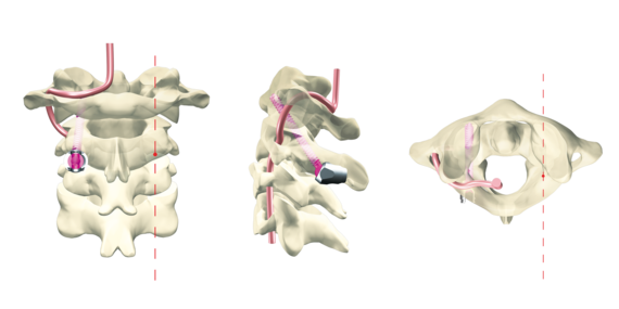© ulrich medical. All rights reserved. Use, reproduction or transfer without express authorization is not permitted.