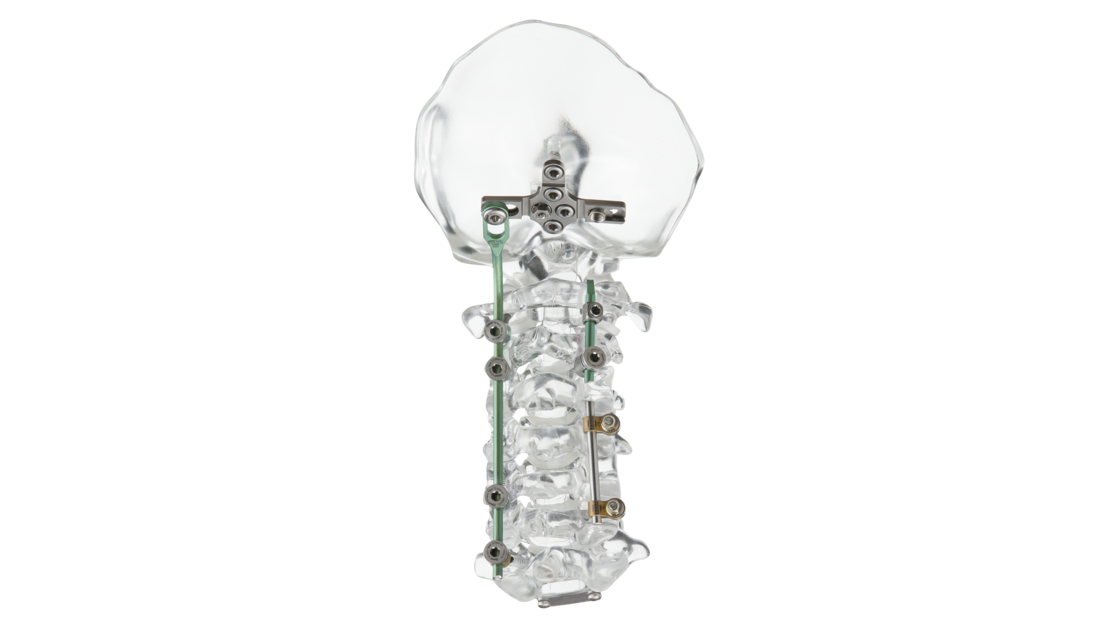 © 2025 ulrich medical. Alle Rechte vorbehalten. Die Verwendung, Vervielfältigung oder Weitergabe ohne ausdrückliche Genehmigung ist nicht gestattet.