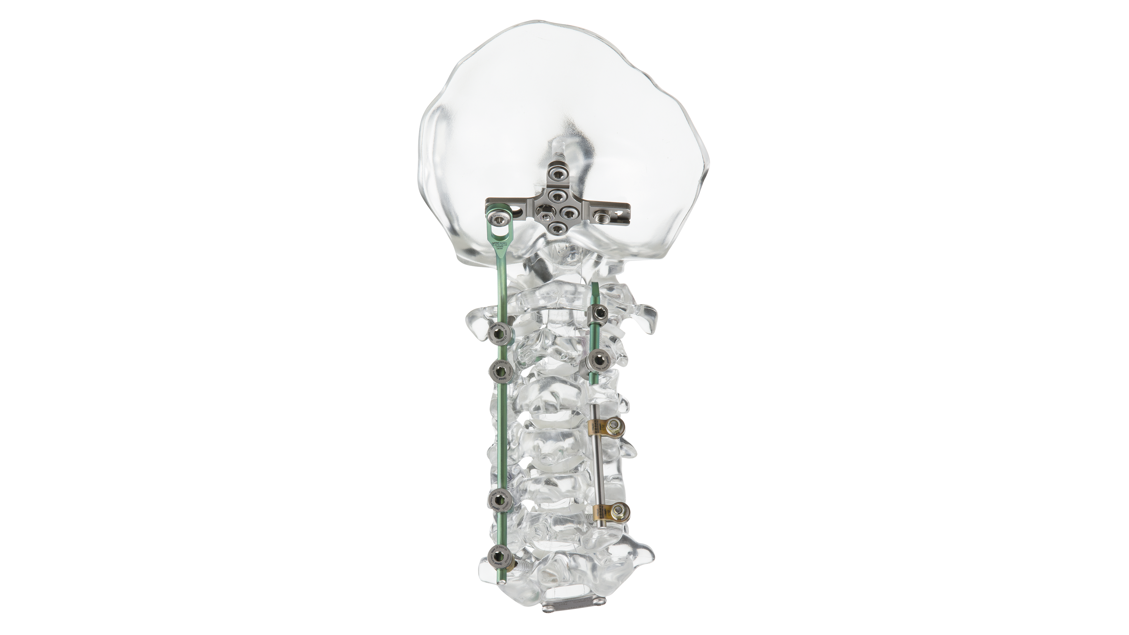 © ulrich medical. All rights reserved. Use, reproduction or transfer without express authorization is not permitted.