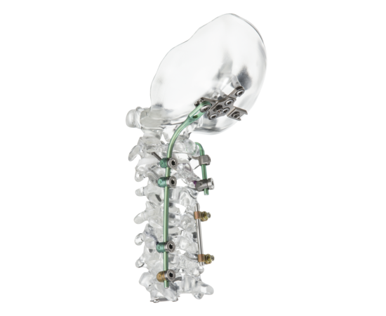 © ulrich medical. All rights reserved. Use, reproduction or transfer without express authorization is not permitted.