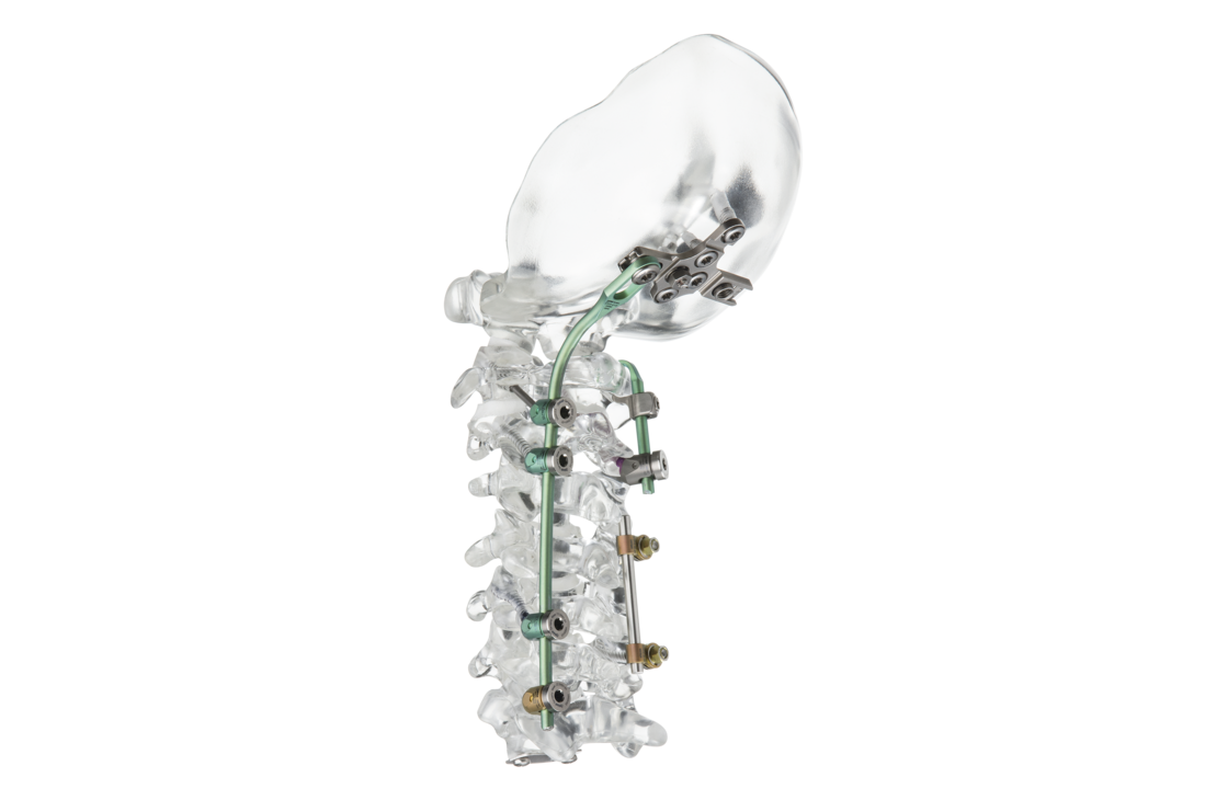 © ulrich medical. All rights reserved. Use, reproduction or transfer without express authorization is not permitted.