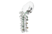 © ulrich medical. All rights reserved. Use, reproduction or transfer without express authorization is not permitted.