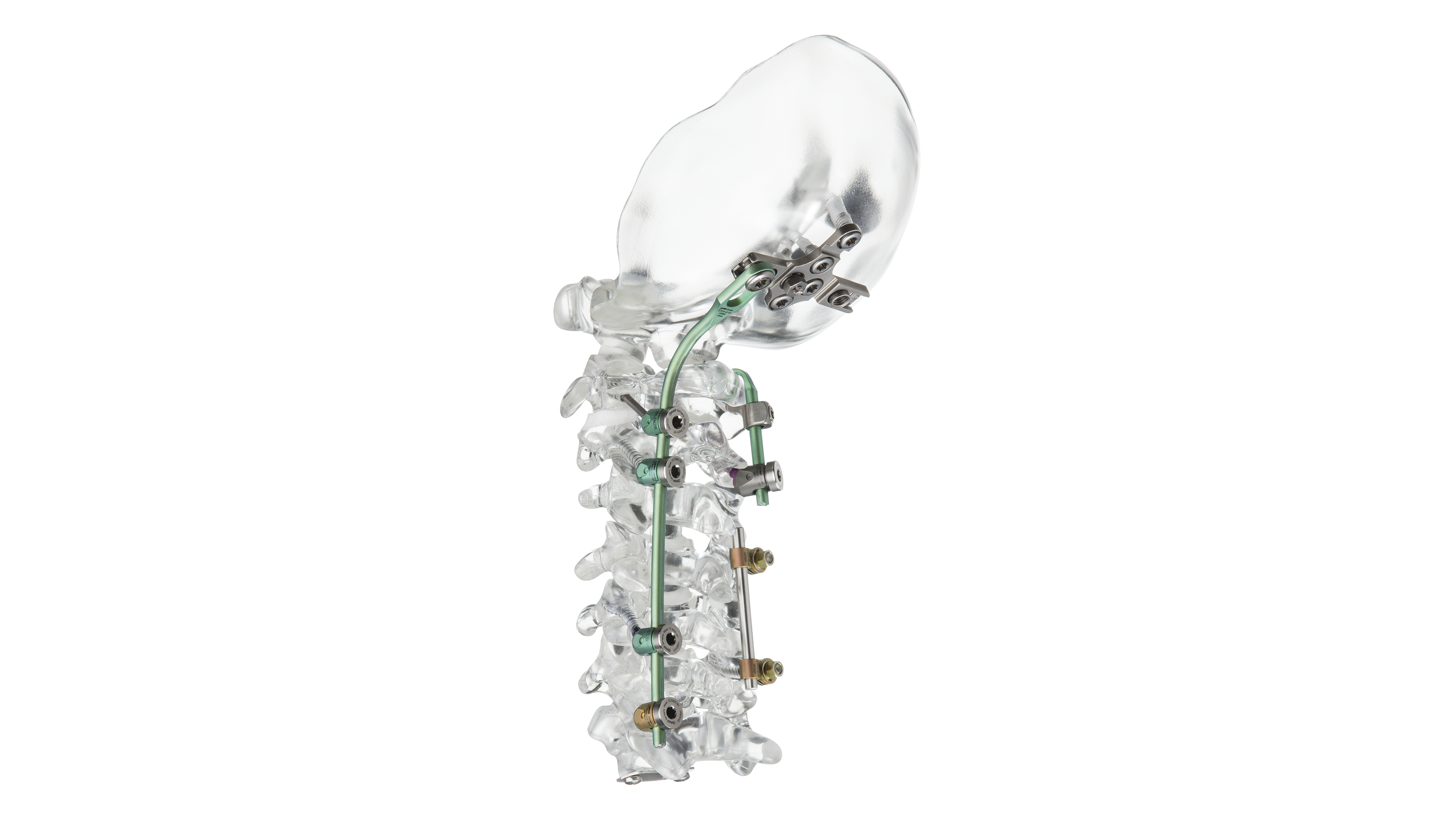 © ulrich medical. All rights reserved. Use, reproduction or transfer without express authorization is not permitted.