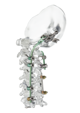 © ulrich medical. All rights reserved. Use, reproduction or transfer without express authorization is not permitted.