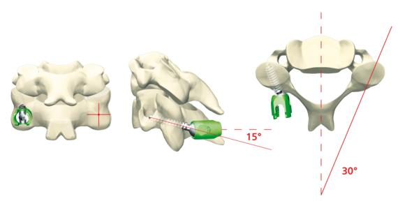 © ulrich medical. All rights reserved. Use, reproduction or transfer without express authorization is not permitted.