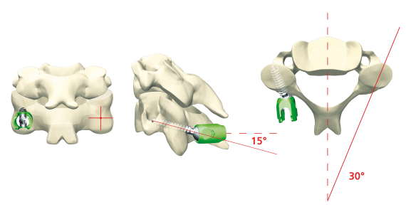 © ulrich medical. All rights reserved. Use, reproduction or transfer without express authorization is not permitted.