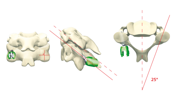 © ulrich medical. All rights reserved. Use, reproduction or transfer without express authorization is not permitted.