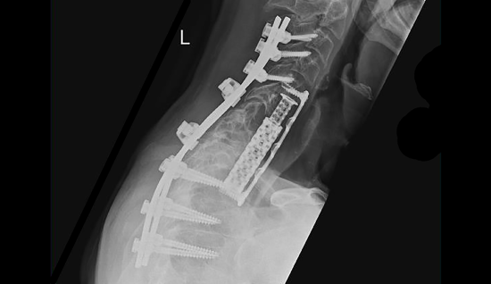 © ulrich medical. All rights reserved. Use, reproduction or transfer without express authorization is not permitted.