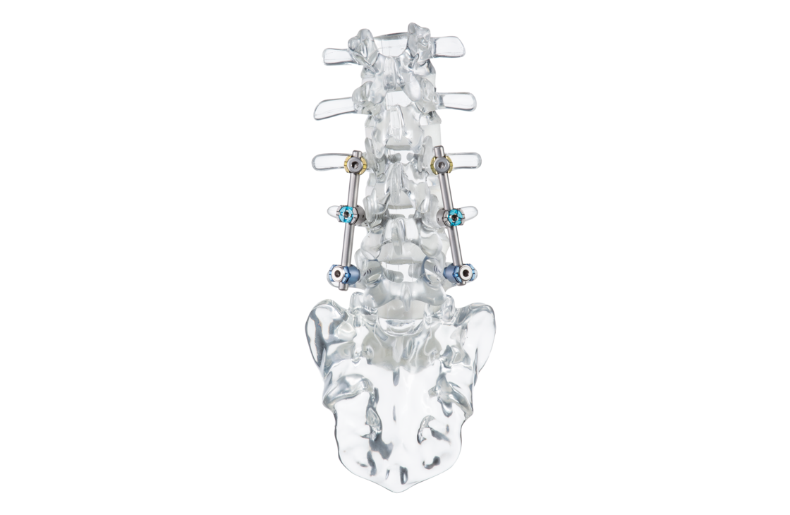 © ulrich medical. Tous droits réservés. L'utilisation, la reproduction ou la transmission sans autorisation expresse est interdite.