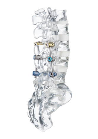 © ulrich medical. All rights reserved. Use, reproduction or transfer without express authorization is not permitted.