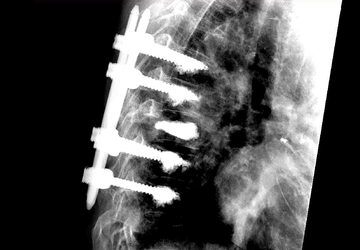 © ulrich medical. Tous droits réservés. L'utilisation, la reproduction ou la transmission sans autorisation expresse est interdite.