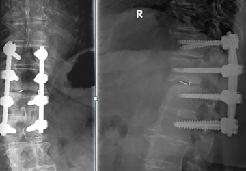 © ulrich medical. All rights reserved. Use, reproduction or transfer without express authorization is not permitted.