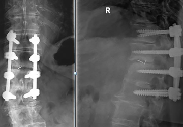 © ulrich medical. Tous droits réservés. L'utilisation, la reproduction ou la transmission sans autorisation expresse est interdite.