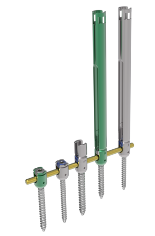 © ulrich medical. Tous droits réservés. L'utilisation, la reproduction ou la transmission sans autorisation expresse est interdite. © ulrich medical. Tous droits réservés. L'utilisation, la reproduction ou la transmission sans autorisation expresse est interdite.