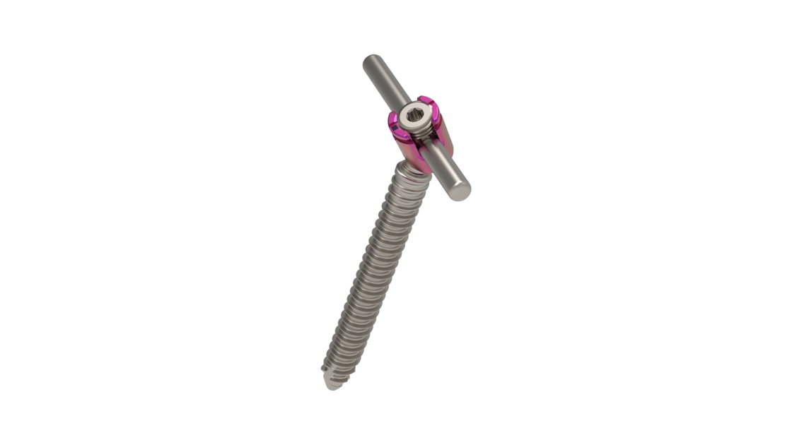 © 2025 ulrich medical. Alle Rechte vorbehalten. Die Verwendung, Vervielfältigung oder Weitergabe ohne ausdrückliche Genehmigung ist nicht gestattet.