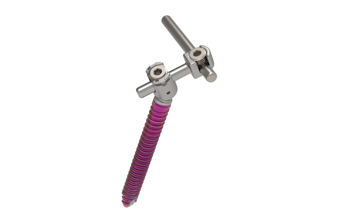 © Ulrich Medical. Todos los derechos reservados. Queda prohibido el uso, la reproducción o la distribución sin autorización expresa.