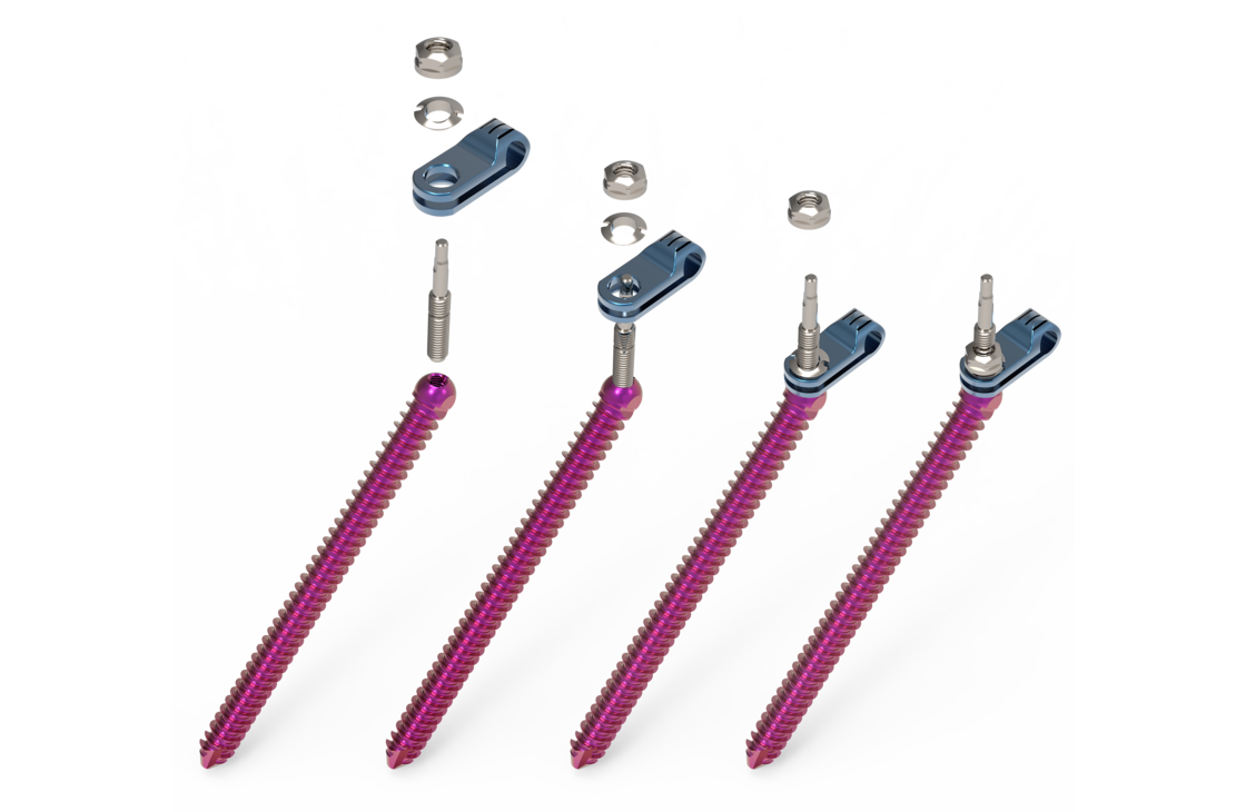 © ulrich medical. Tous droits réservés. L'utilisation, la reproduction ou la transmission sans autorisation expresse est interdite.