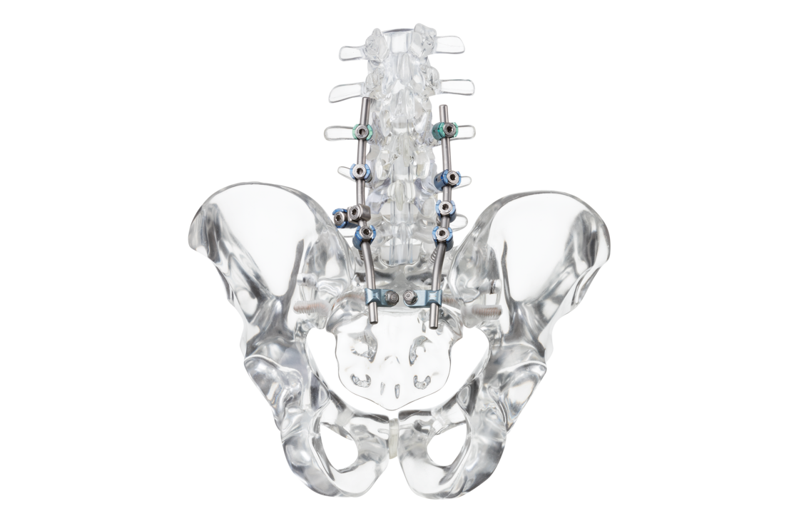 © ulrich medical. Tous droits réservés. L'utilisation, la reproduction ou la transmission sans autorisation expresse est interdite.