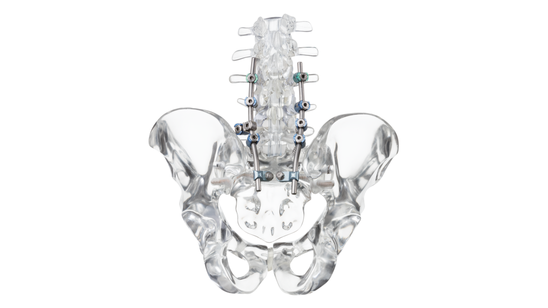 © 2025 ulrich medical. Alle Rechte vorbehalten. Die Verwendung, Vervielfältigung oder Weitergabe ohne ausdrückliche Genehmigung ist nicht gestattet.