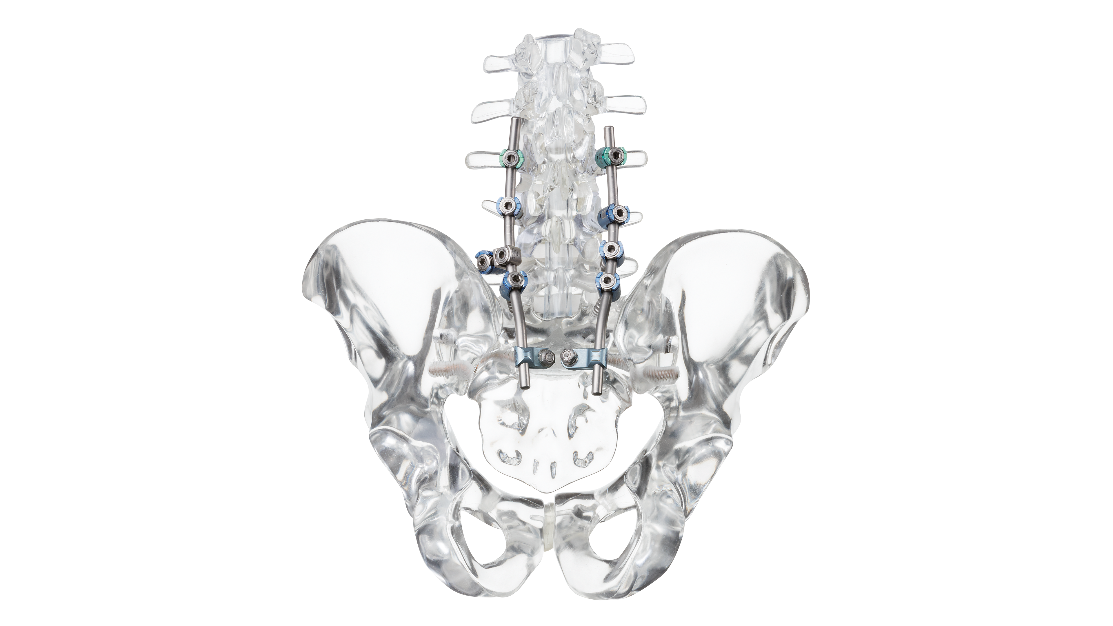© ulrich medical. All rights reserved. Use, reproduction or transfer without express authorization is not permitted.