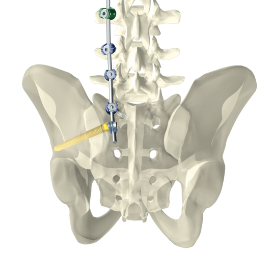 © ulrich medical. Tous droits réservés. L'utilisation, la reproduction ou la transmission sans autorisation expresse est interdite.