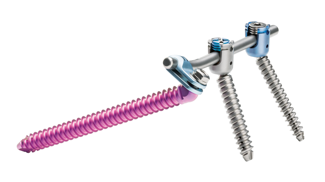 © ulrich medical. Tous droits réservés. L'utilisation, la reproduction ou la transmission sans autorisation expresse est interdite.